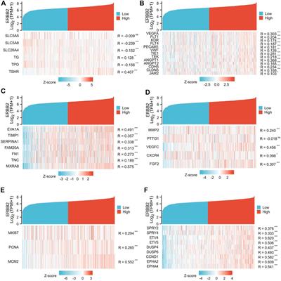 ERBB2 as a prognostic biomarker correlates with immune infiltrates in papillary thyroid cancer